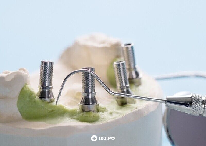 Спутник Бэби Стоматология - стоматологическая клиника  «Спутник Бэби» - фото 1573343