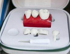 Круглосуточная стоматология Диамант, Галерея - фото 3