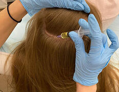 Клиника по лечению волос и кожи АМД Лаборатории, Галерея - фото 5