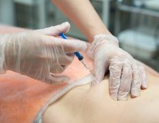 Медицинский центр красоты и здоровья Biormed (Биомед), Biormed - фото 17