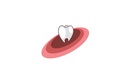 Отбеливание зубов — Стоматологическая клиника «Golden Dent (Голден Дент)» – цены - фото